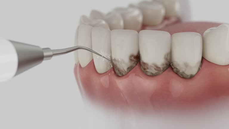 Reliable Emergency Dentist contractor in Albemarle, NC by Smile Center Dentistry